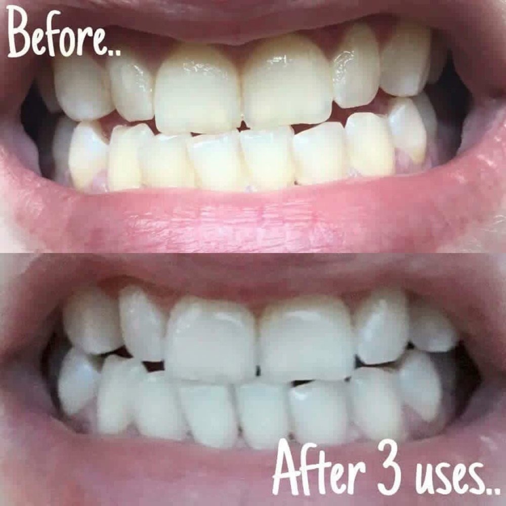 Whitening toothpaste 2 on hand ready to ship♥️